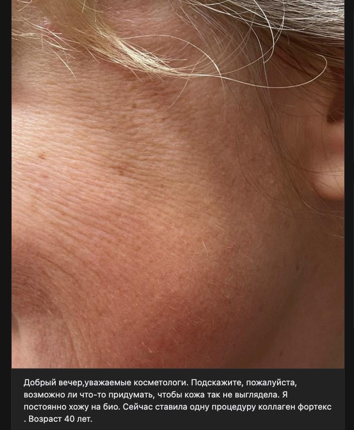 женская щека с морщинами